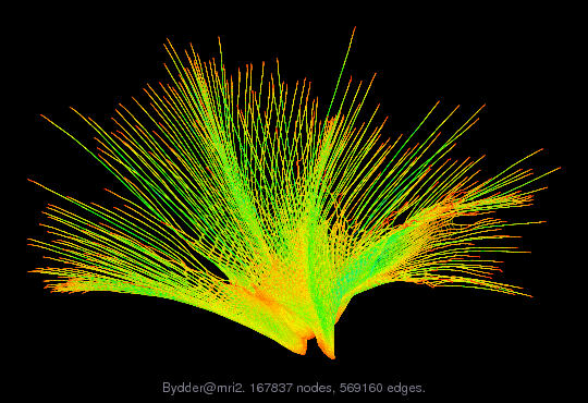 Force-Directed Graph Visualization of Bydder/mri2